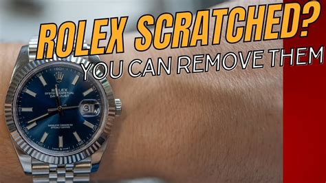 how to save scratches on my rolex watch